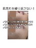 【ニキビ・赤み・肌荒れ】鎮静×回復レストセルケア ¥10,000⇒