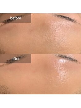 ナウ(now)/【陶肌トリートメント】