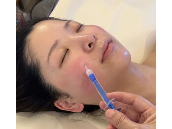 ティアラ(TIARA)/スピキュールがお肌にチクチク!