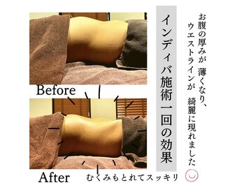 グランツ 小山店/インディバ施術1回