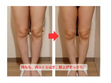 オスマンティエ(Osmantier)/施術ビフォーアフター