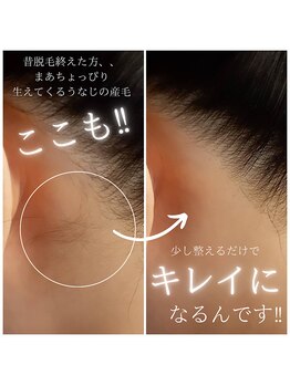 ボーテ ドゥ ランジュ(BEAUTE DE L’ANGE.)/【うなじ脱毛】