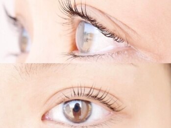 フェリシータ ジール(FELICITA ZEAL)の写真/まずは丁寧なカウンセリングであなたの理想をしっかり把握!施術後は横顔&至近距離&素顔美人に◎