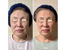 アイディー(Id)/大人気!整′形パック!