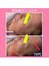 レアナ(LEANA)/70代　コルギ