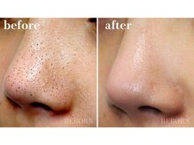 リボーン(REBORN)