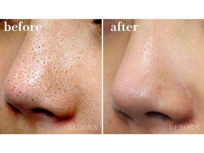 リボーン(REBORN)の写真