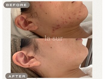 ラシュール(la sur)/