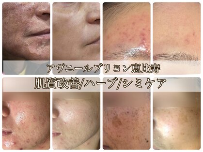 アブニールブリヨンの写真