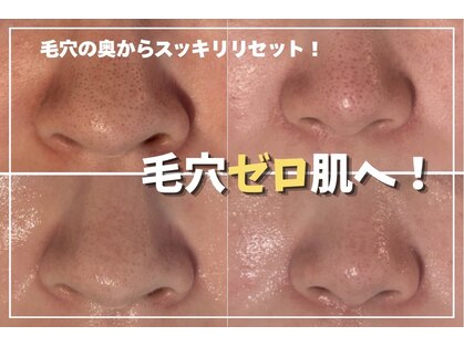 センシズ(Senses)の写真