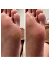 快歩堂フットケアセンター 日本橋館/歩くとツラい魚の目も◎