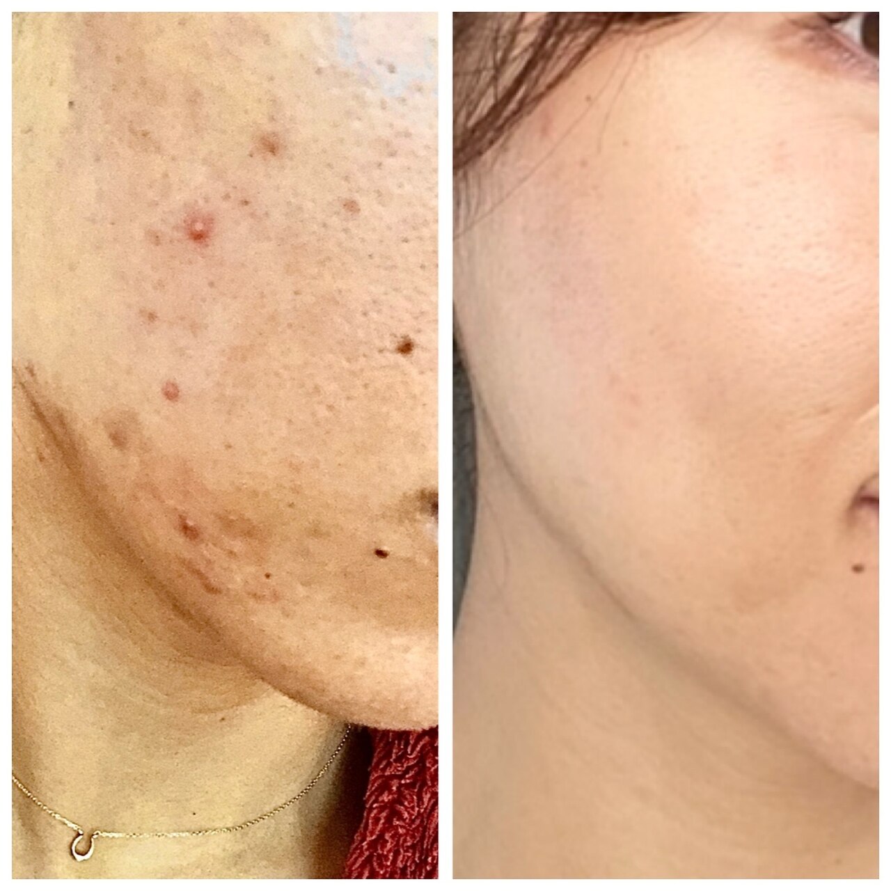 ビューティーテクニクス 四ツ橋店(BEAUTY TECHNICS)｜ホットペッパー