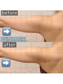 サロンデイジー(Salon Daisy)/winback痩身★施術一回