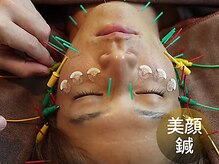 杉本接骨鍼灸院/美顔鍼でワンランク上の美肌体験
