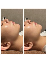 マヴィ 香里園店(MavY.)/ぐんっとリフトアップ