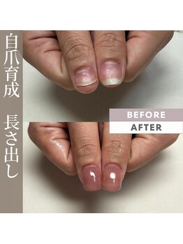 プリンチペッサジゼル/自爪育成長さ出し