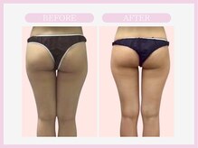 スリムライン 盛岡店(The Slim Line)/before→after