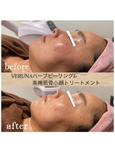 ココ 2号店(CoCo)/筋骨小顔トリートメント