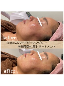 ココ 2号店(CoCo)/筋骨小顔トリートメント