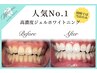 【本格ケア◎人気No.1】高濃度ジェル使用★プレミアセルフホワイト14,300円⇒