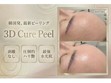 アザレア(Azalea)の雰囲気（【3Dキュアピーリング/毛穴/サーマジェン/マイクロウェーブ】）