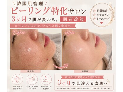 カエラ(KAELA)の写真