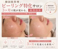 カエラ(KAELA)