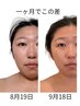 小顔リフトアップ美肌ケア60分