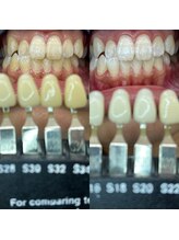 トウキョースワーズ 渋谷店(TOKYO SWRS)/#ホワイトニング #渋谷 #池袋