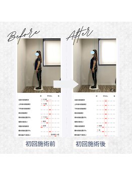 ラクリエ 東加古川院(La Creer)/お客様ビフォーアフター