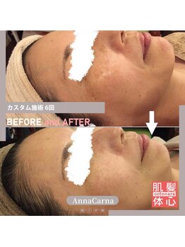 アンナカルナ(AnnaCarna)/年齢肌対策は水分チャージから