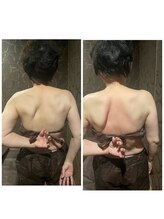トータルビューティーサロン ヴィヴィエ(ViVier)/肩甲骨剥がし症例1回