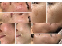 ラグーナ(Laguna)の雰囲気（【ハーブ/タラソ/マーメイド/レスト】トラブルの起因ケアが大事!）