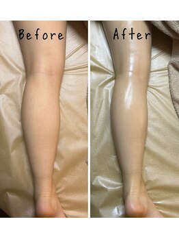 フィール(feel)/Before/After リンパマッサージ