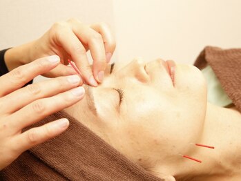 浦和のあ鍼灸整骨院の写真/【国家資格者による施術】美容鍼でむくみやたるみを改善しリフトアップ◎スッキリとしたフェイスラインに♪