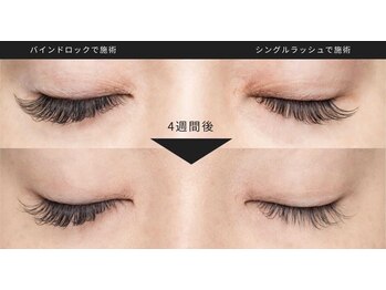 モーイ ブルップ 高槻店(mooi beloep)/バインドロック１００本