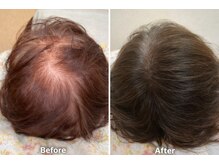 トータルビューティーサロンリア(Li'a)/髪や頭皮の様々なお悩みに