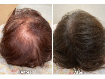 トータルビューティーサロンリア(Li'a)/髪や頭皮の様々なお悩みに