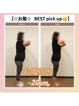 えのもと美容整体院/【痩身整体ダイエット】