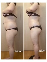 アンフィニ(infini)/短期集中コース8回（3ヶ月)