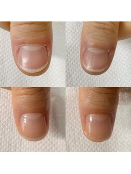 カンパニュラ(Campanula)/自爪育成コース