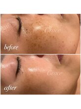 グレイス/最新光フォト