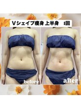 ルピナス ヒサヤ(LUPINUS hisaya)/Vシェイプ痩身