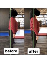 カワル整体 上通り院/外ももの張りが取れない原因