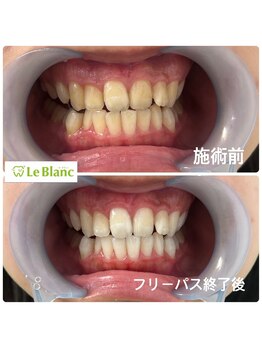 ルブラン 奈良店(Le Blanc)/フリーパスコース！