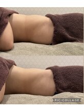 シャルム(CHARME)/赤岩式腸けずり