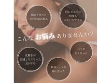 アルモ(ALMO)の雰囲気（美容液毛穴洗浄/BHF/フェイシャルエステによる肌質改善も好評♪）