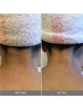 ハウオリ スパ(Hau’Oli Spa)/【ブライダルエステ】