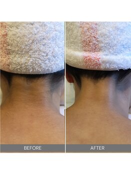 ハウオリ スパ(Hau’Oli Spa)/【ブライダルエステ】