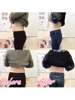 整体院 トトノウ(TotonoU)/着たい服を着れます！！